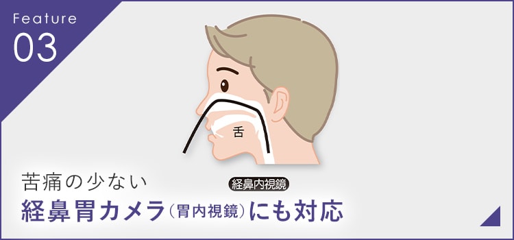 苦痛の少ない経鼻胃カメラ（胃内視鏡）にも対応